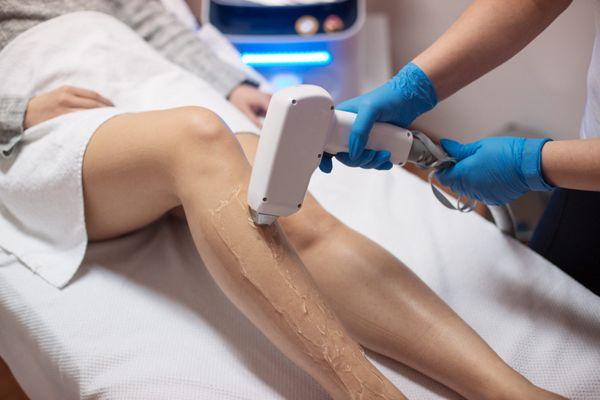 LEGS LASER HAIR REMOVAL