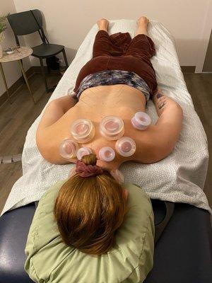 Cupping and Acupuncture treatment.