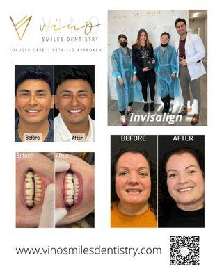 Services include, but not limited to, veneers, implants, Invisalign, braces, teeth whitening, root canals, crowns, and much more.