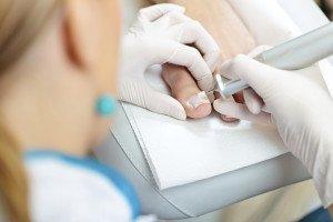 Ingrown Toenail Treatment