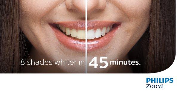 Zoom! whitening -- In Office whitening. Have the smile you've always wanted!