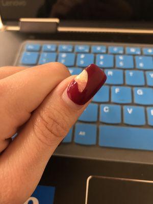 Broken nail