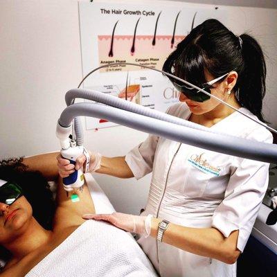 SplendorX, latest blended technology in Laser hair removal exclusively @chiselleaesthetics