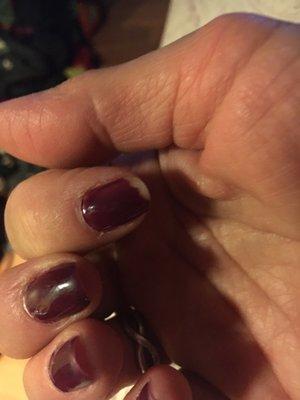 Chip on index finger after only 3 days of a shellac manicure