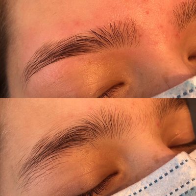 Brow threading on young girl.