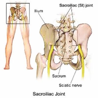 Sacroiliac dysfunction is something Jeff at Pro Massage encounters on a daily basis.