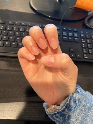 Uneven nails, cut cuticles