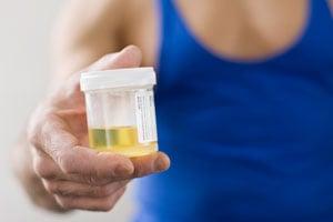 Urine Testing