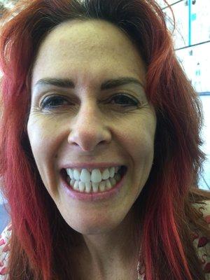 Stephanie is showing off her whiter teeth!