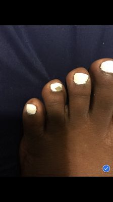 Toe nail polish chipped after one day . Polish is sloppy as well