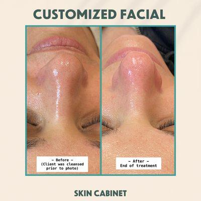 Customized facial tailored to clients concerns. Notice she's brighter and pores are clearer.