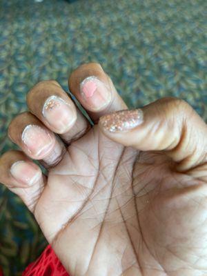 Fingernails