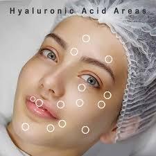 Hyaluron Pen Treatment