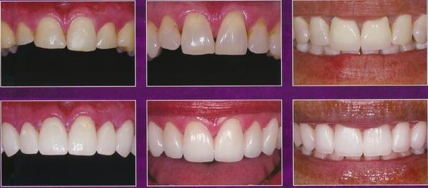 Cosmetic Dentistry