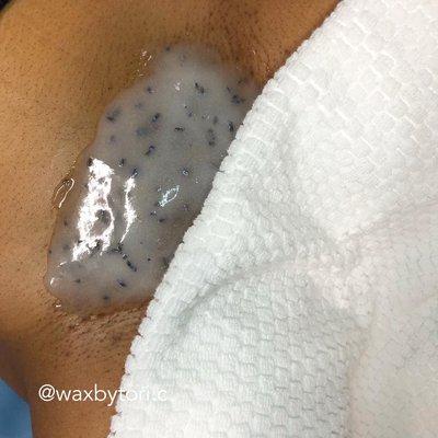 Hydrojelly Mask following a Brazilian wax. Restores hydration to the skin and reduces irritation!