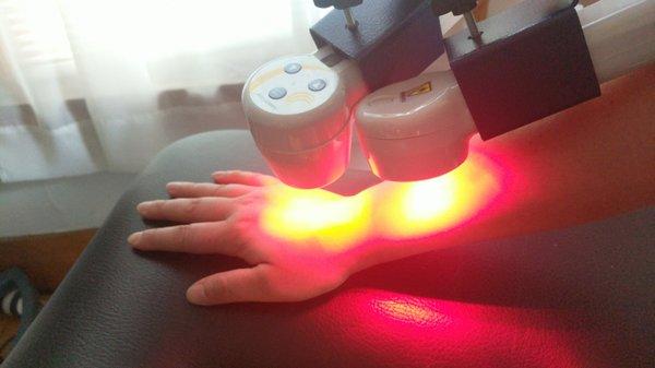 Cold laser therapy