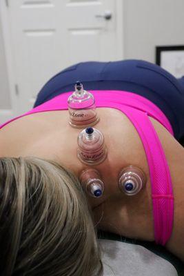 Cupping