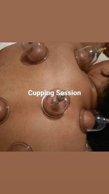 Cupping session for inflammation & pain relief.