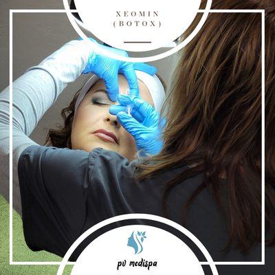 Xeomin / botox treatment