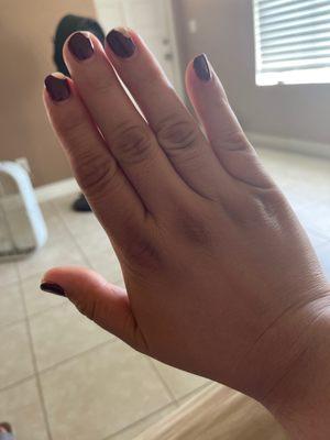 These are my nails at 6 day ? It shouldn't be like this