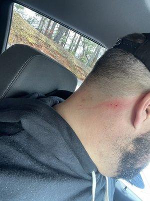 Appreciate the blade clean up on the back of the neck but this one stung.