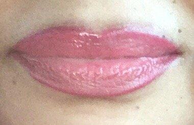 Lips color touch up by Dr. Mirtha.  Been going to her for 15 years