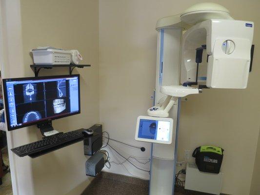 State of the art Cone Beam CT