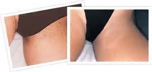 Bikini wax, brazilian waxing, french bikini wax,