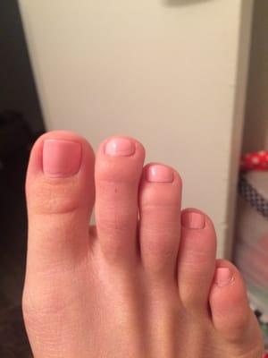 Terrible pedicure, doesn't look professionally done at all.