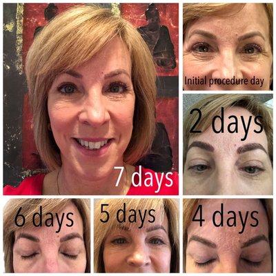 Microblading