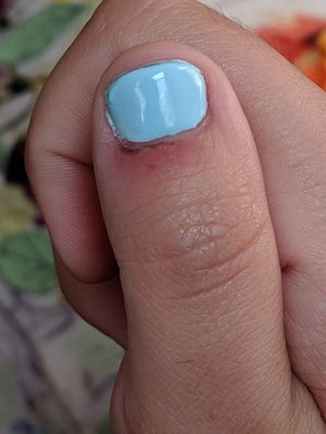 Close up of nail