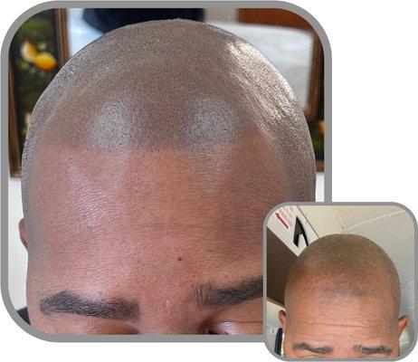 Natural results hair tattoo at Scalp Micro Arts Scalp Micropigmentation Hair Clinic Wayne, NJ