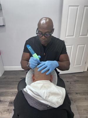 Scalp Micropigmentation (SMP)