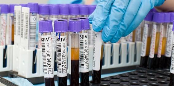 Blood and urine testing is performed in a reference laboratory certified by State and Federal Agencies.