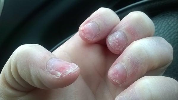 destroyed my nails