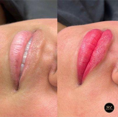 Lips Micropigmentation