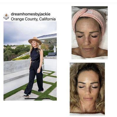 Absolutely beautiful results for this OC stunning beauty/Local Newport Beach Top OC Realtor! 1 (949) 395-6781