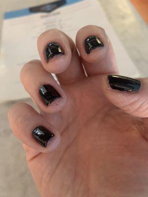 My terrible nails