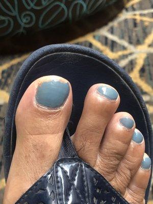 4 day old pedi