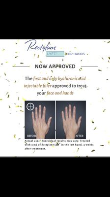 New APPROVED service for the hands! We're first in the area to offer your this amazing treatment!