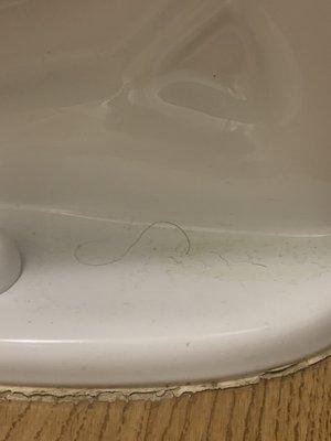 Someone's hair and pee