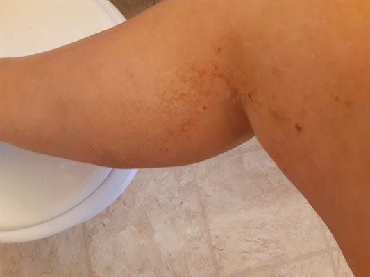 My leg where the lotion was rubbing off in a little crumbles