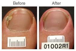 Dr. Halinski provides a variety of podiatry services.