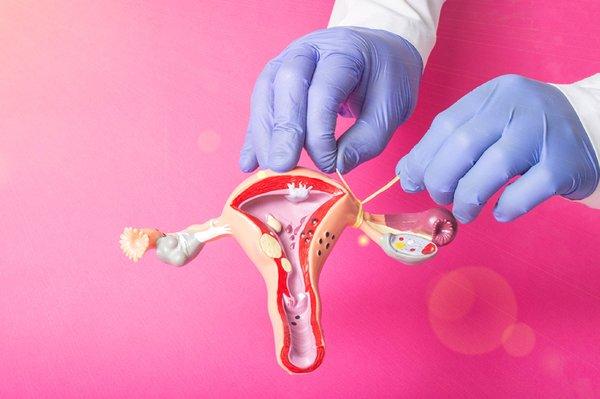 Tubal Ligation