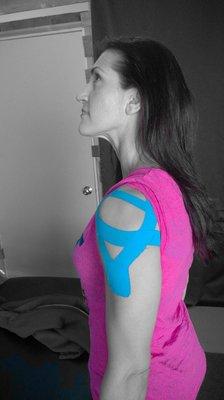 Kenisio Taping for shoulder stability