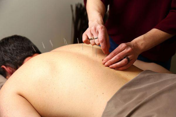 Acupuncture is serine setting.