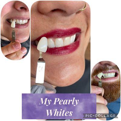 My Pearly Whites