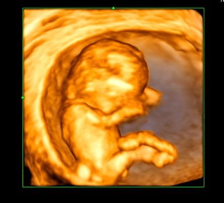 Early 3D image of this beautiful baby!