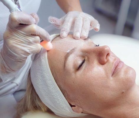 Microdermabrasion