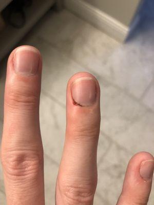 Cut from trimming cuticles - has been bleeding off and on all day!